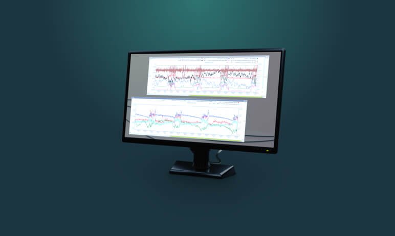 Operation analysis illustration